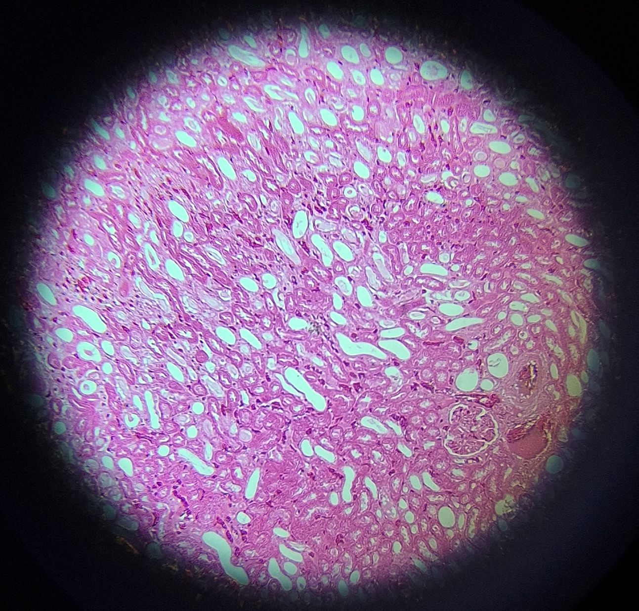 no-87-rein-l-s-kidney-of-l-s